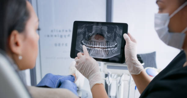 Licensed Tooth Extraction service in Pico Rivera, CA - Smile Center Dentistry